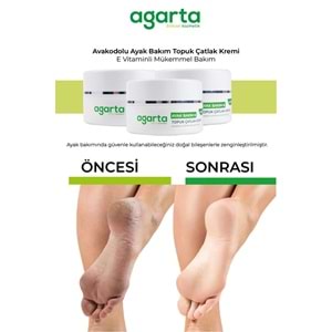 Agarta Ayak ve Topuk Çatlak Bakım Kremi 100ML